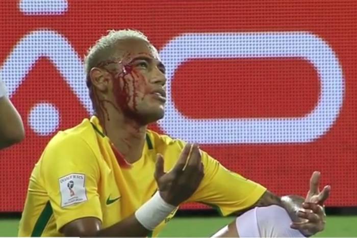 Eliminacje MŚ: Brazylia znów gra pięknie, Neymar zszedł z rozciętym łukiem brwiowym [VIDEO]