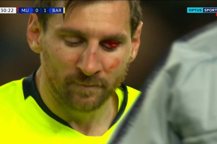 Leo Messi uderzony przez obrońcę Manchesteru United. Krew na twarzy Argentyńczyka [WIDEO]
