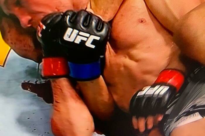 Krwawa wojna w UFC! Niesamowity cios łokciem i konieczność założenia osiemnastu szwów [WIDEO]