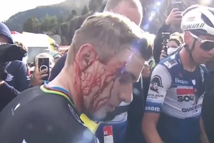 Kolarz wjechał prosto w kibiców. Groźne sceny podczas Vuelta a Espana. Strugi krwi na twarzy zwycięzcy [WIDEO]
