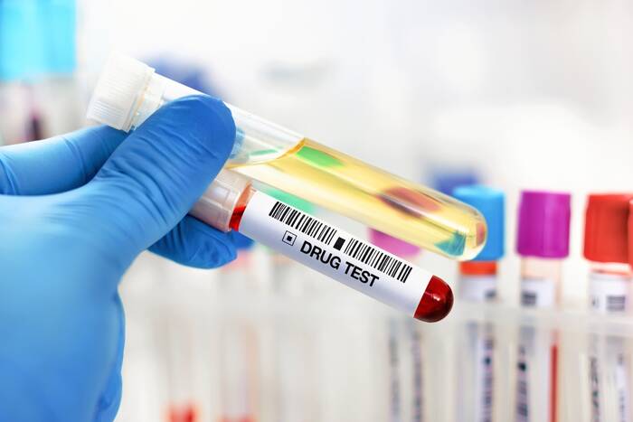 Wykryli doping u wszystkich piłkarek. Tego jeszcze nie było Wykryli doping u wszystkich piłkarek. Tego jeszcze nie było