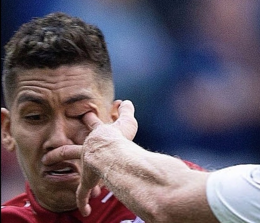 Firmino: Bałem się, że oślepnę na jedno oko