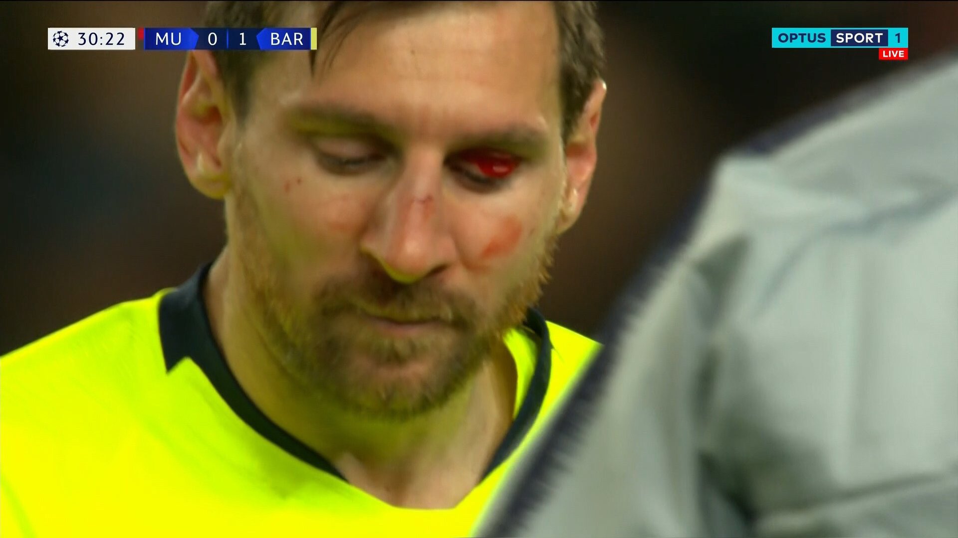 Leo Messi uderzony przez obrońcę Manchesteru United. Krew na twarzy Argentyńczyka [WIDEO]