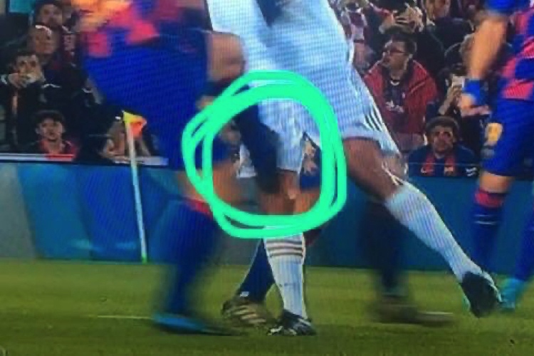 Raphael Varane pokazał udo po faulu Lengleta. Wyraźny ślad po wejściu [ZDJĘCIE]
