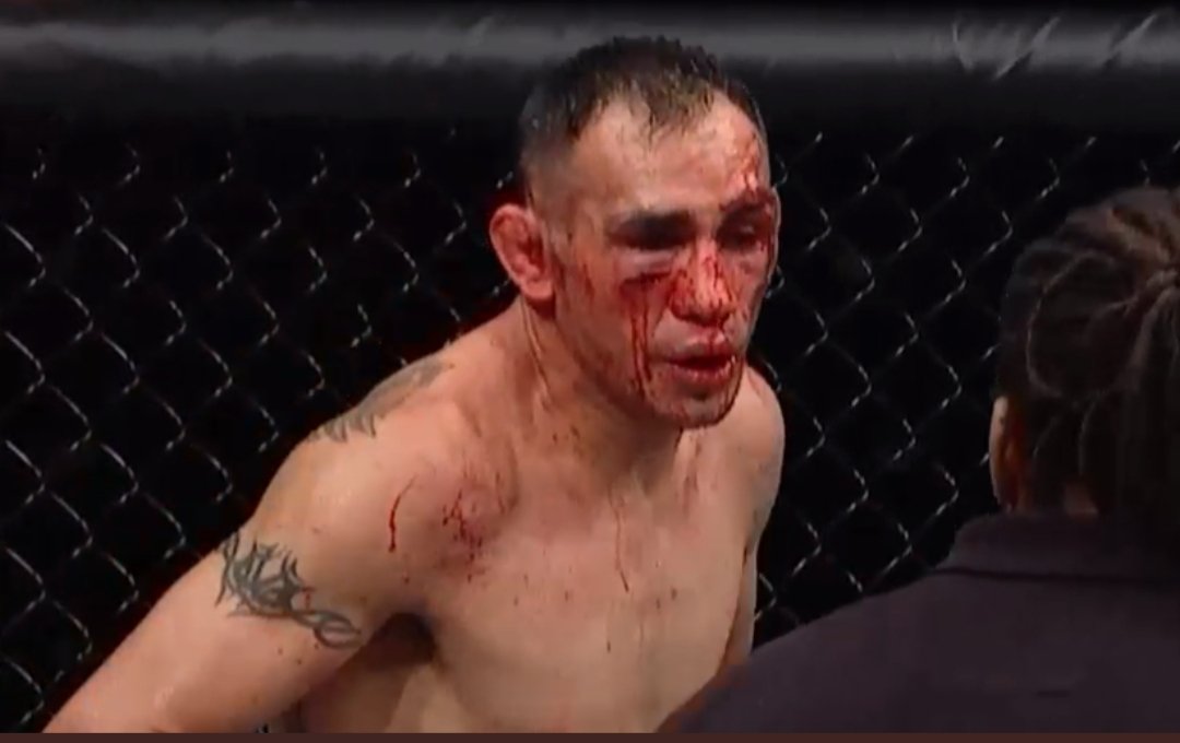 Krwawa jatka w walce wieczoru. Niespodziewane rozstrzygnięcie na gali UFC 249 [WIDEO]