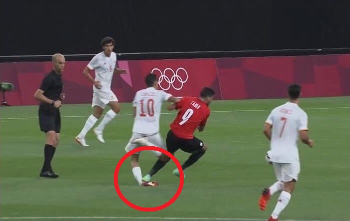 Dani Ceballos pokazał efekt brutalnego faulu. Jego kostka jest w opłakanym stanie [ZDJĘCIE]
