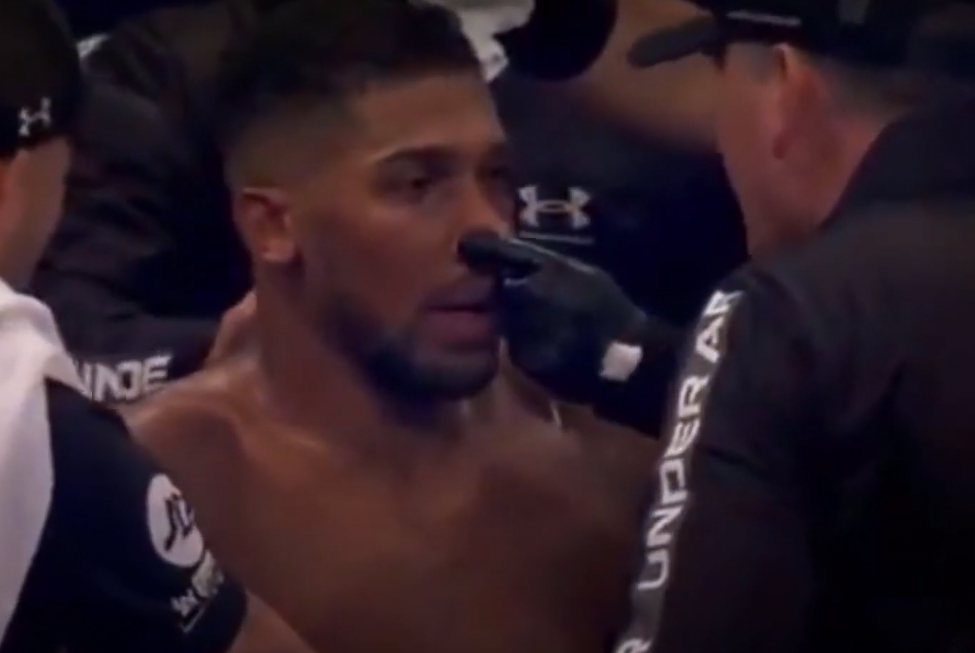 Anthony Joshua prosto z ringu pojechał do szpitala. "Nie widziałem na jedno oko. To było dobre doświadczenie"