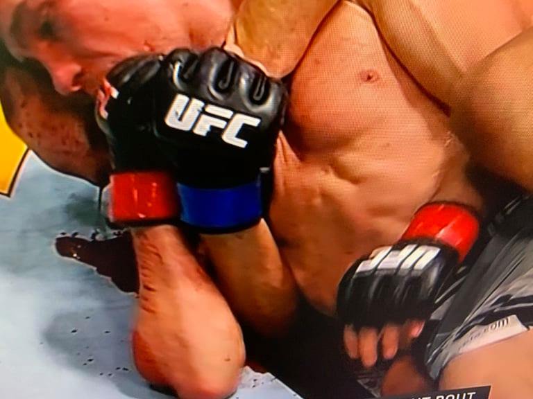 Krwawa wojna w UFC! Niesamowity cios łokciem i konieczność założenia osiemnastu szwów [WIDEO]