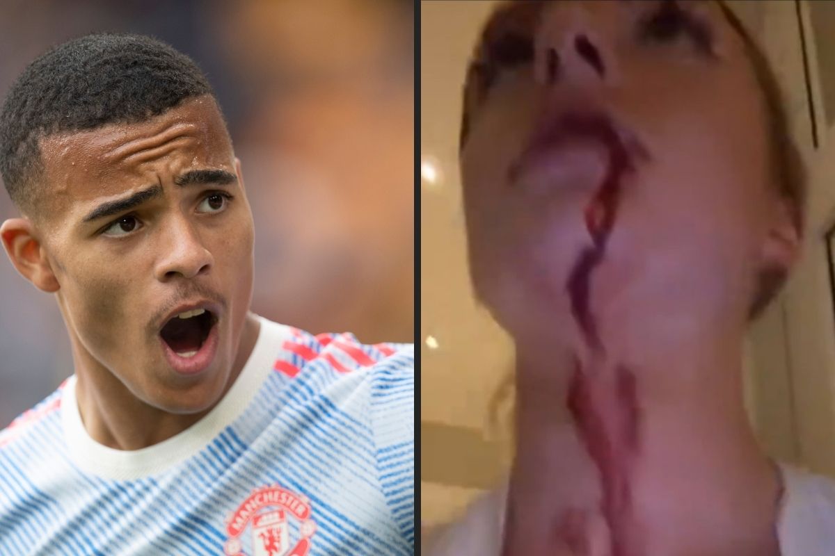 Skandal z udziałem napastnika Manchesteru United. Jest oskarżony o pobicie, wstrząsające materiały [WIDEO]