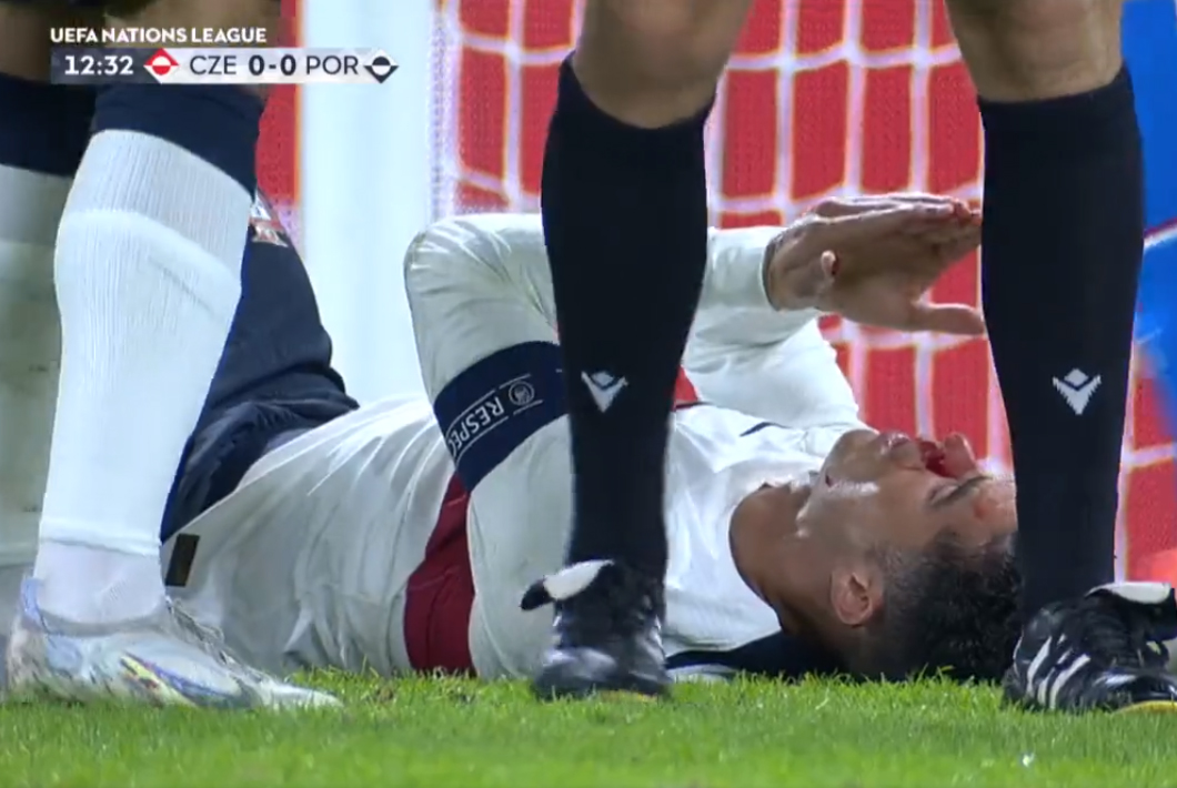 Groźna sytuacja z udziałem Cristiano Ronaldo. Portugalski gwiazdor zalał się krwią [WIDEO]