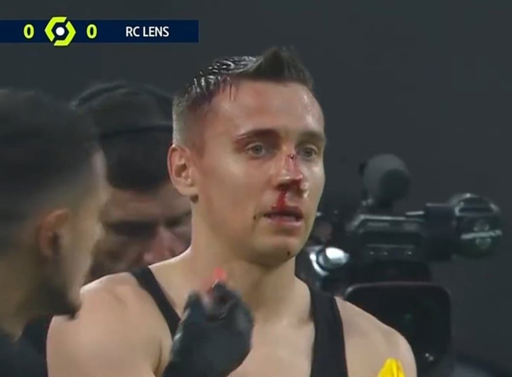 Przemysław Frankowski zalał się krwią. Groźne zdarzenie z udziałem reprezentanta Polski
