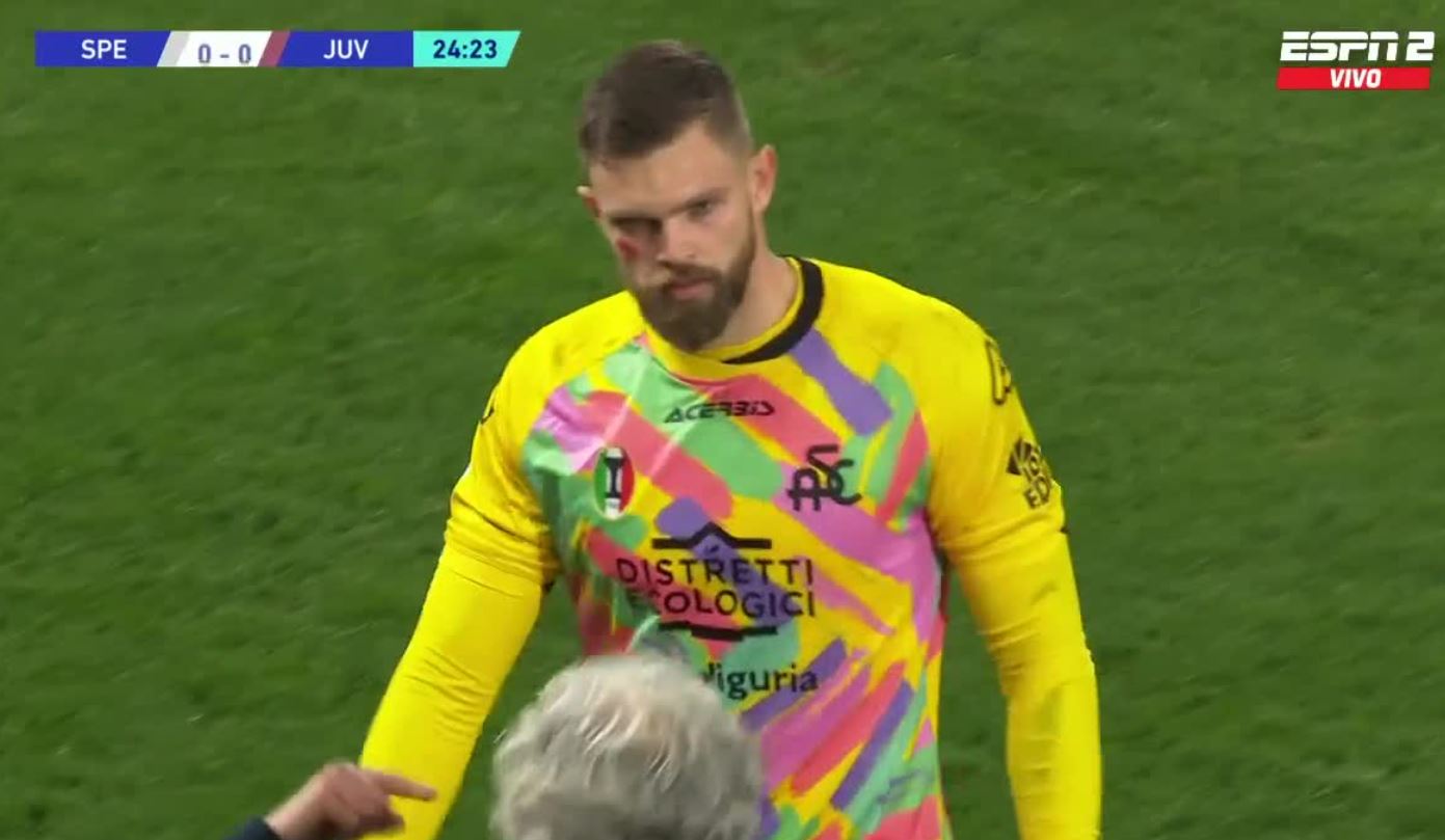 Kolejna kontuzja reprezentanta Polski, nie dokończył ważnego meczu. Spezia bez recepty na Juventus [WIDEO]