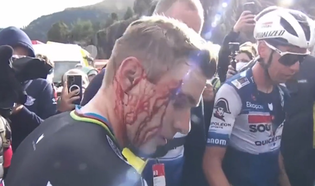 Kolarz wjechał prosto w kibiców. Groźne sceny podczas Vuelta a Espana. Strugi krwi na twarzy zwycięzcy [WIDEO]
