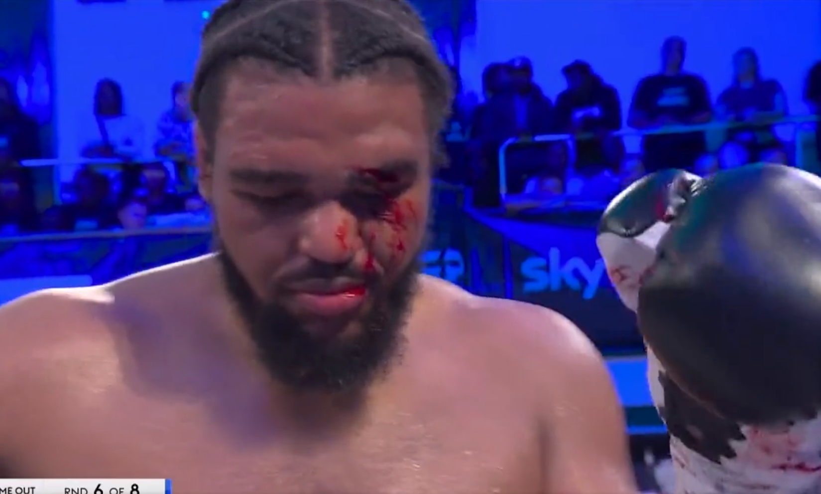 Niepozorny cios mógł mieć opłakane skutki. Pięściarzowi groziła utrata wzroku [WIDEO]