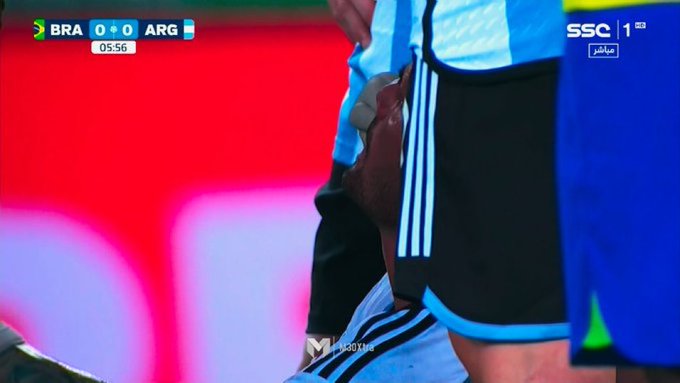 Argentyńczyk zaczął krwawić już na początku meczu z Brazylią! Brutalny atak rywala [WIDEO]