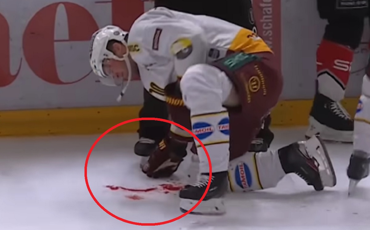 Koszmarne sceny podczas meczu hokeja. "Wszędzie była krew"