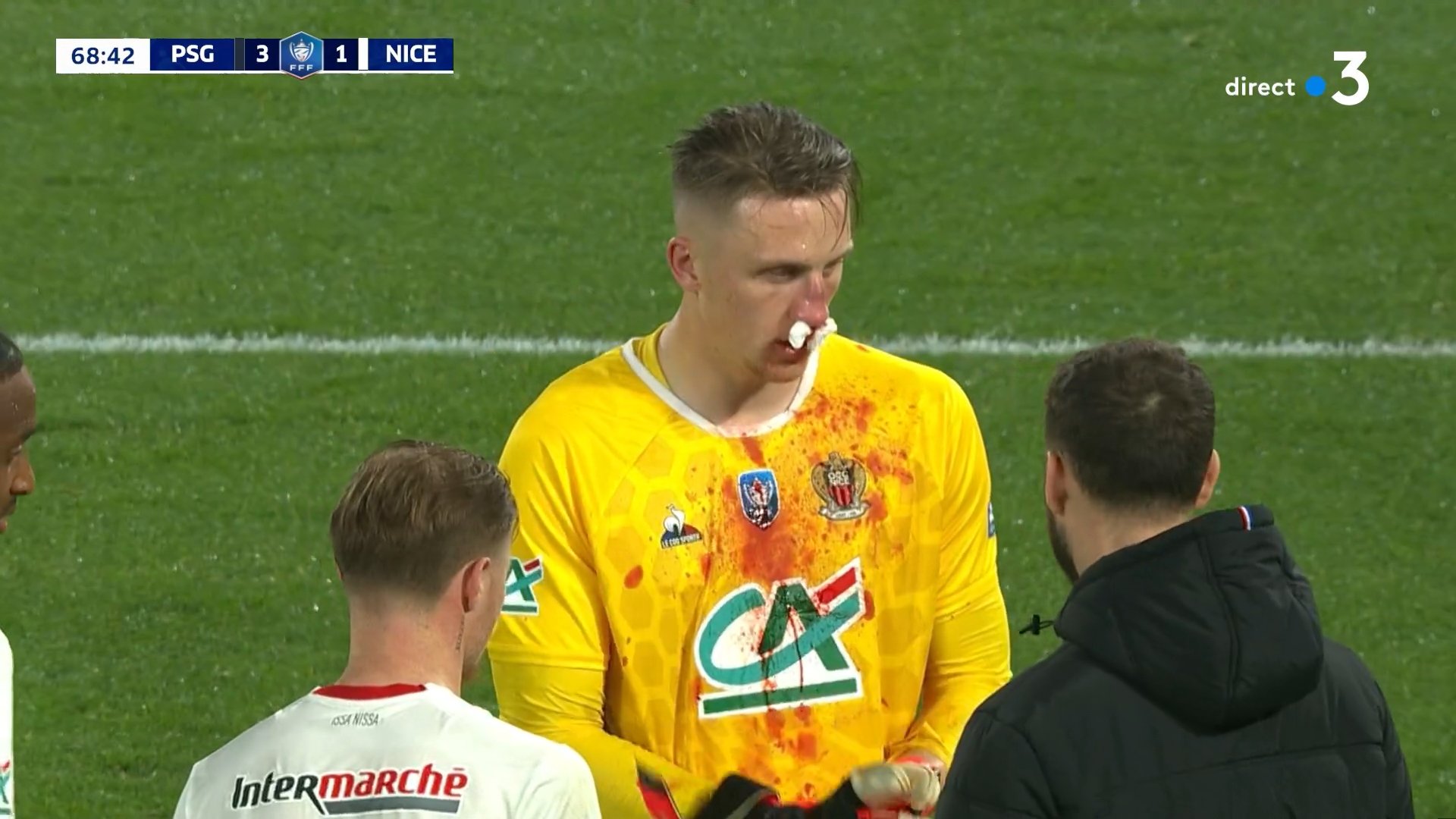 Świetny występ PSG! Bułka kończył mecz z rozkwaszonym nosem, zalał się krwią [WIDEO]