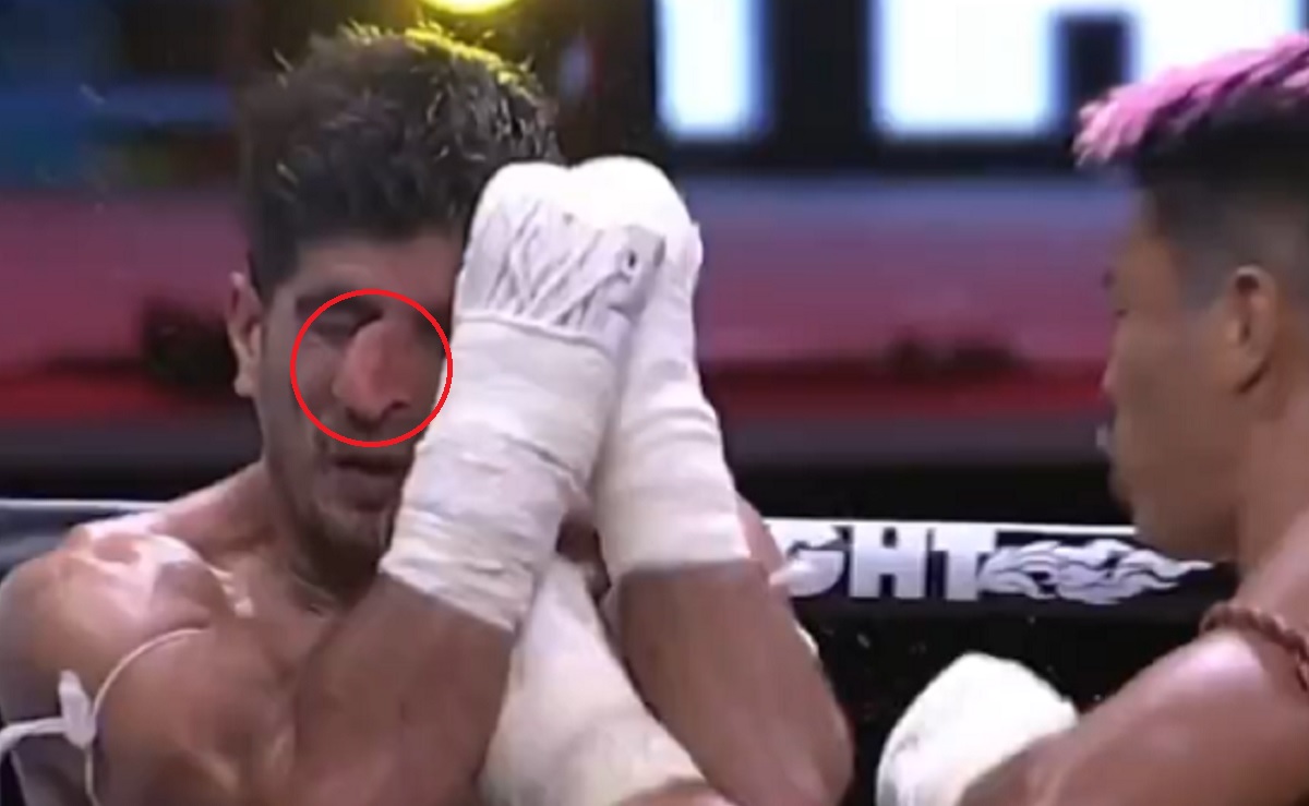 "Wysłał jego nos… do innego wymiaru!". Makabryczna kontuzja zawodnika [WIDEO]