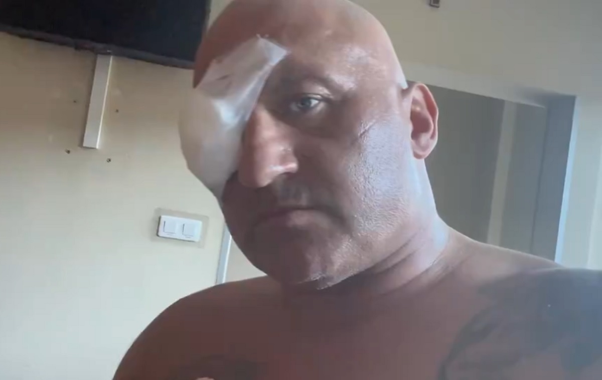 Najman wylądował w szpitalu. Musiał przejść operację po walce na Clout MMA 4