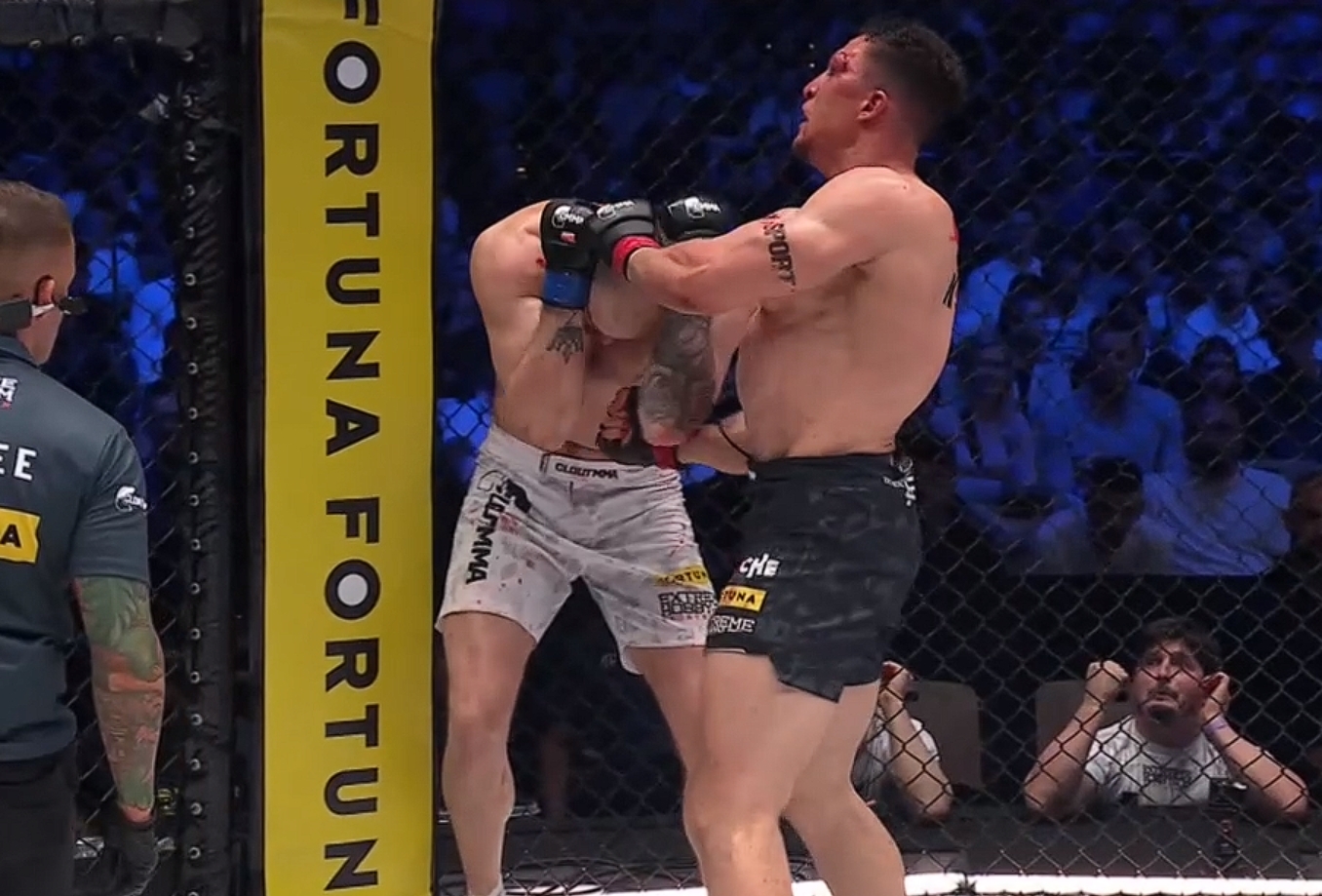 Zmasakrowana twarz freakfightera. Pokazał, jak wygląda po walce na Clout MMA 5 [ZDJĘCIE]