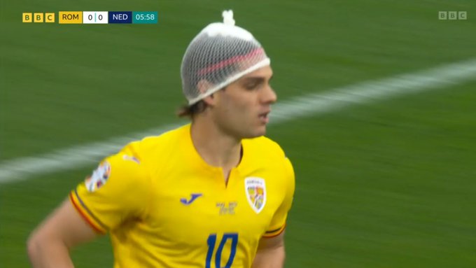 Krew już na początku meczu! Niebezpieczne obrazki na EURO