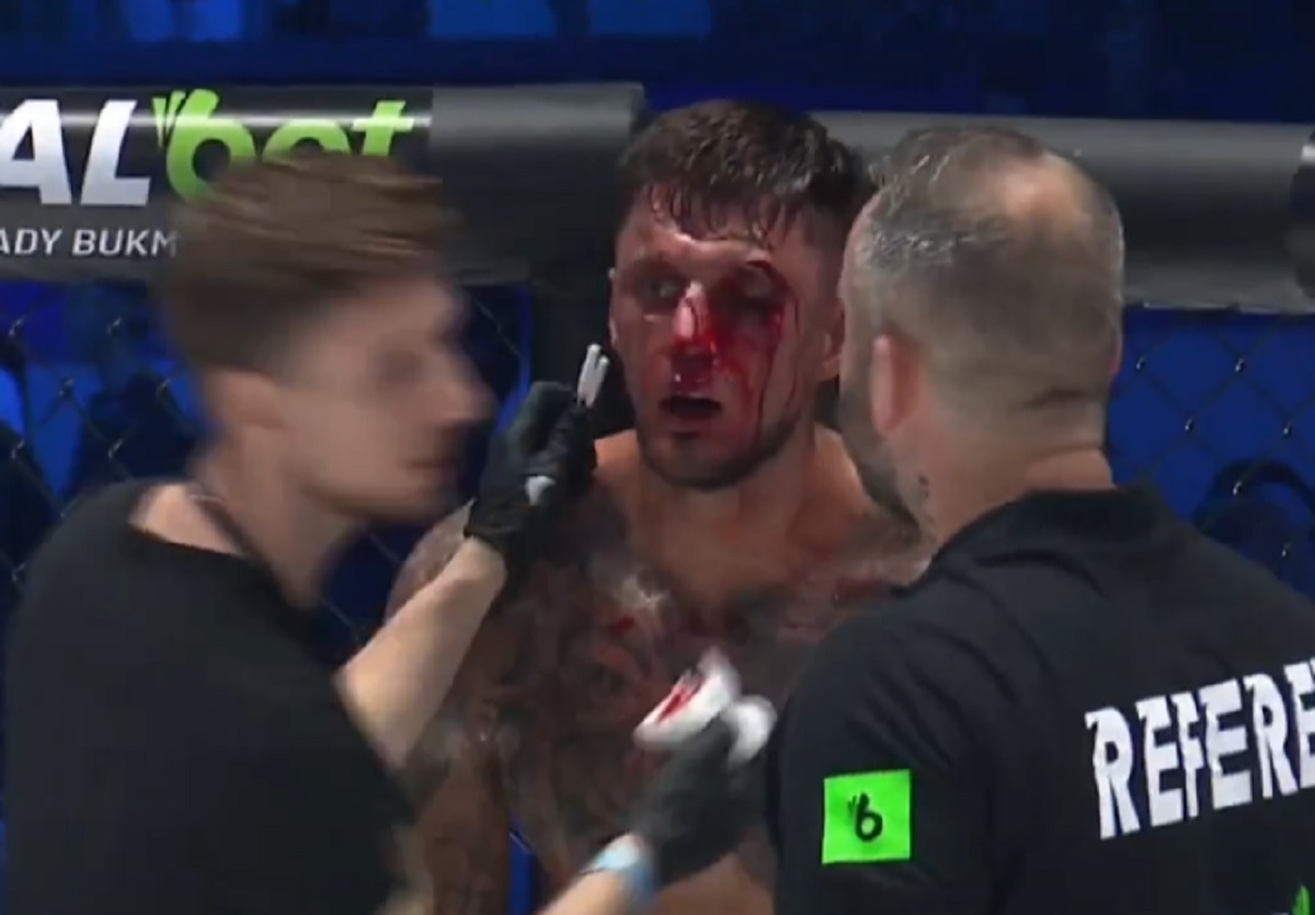 Zmasakrowana twarz freakfightera. Tak wyglądał po walce na Prime MMA 9 [ZDJĘCIE]