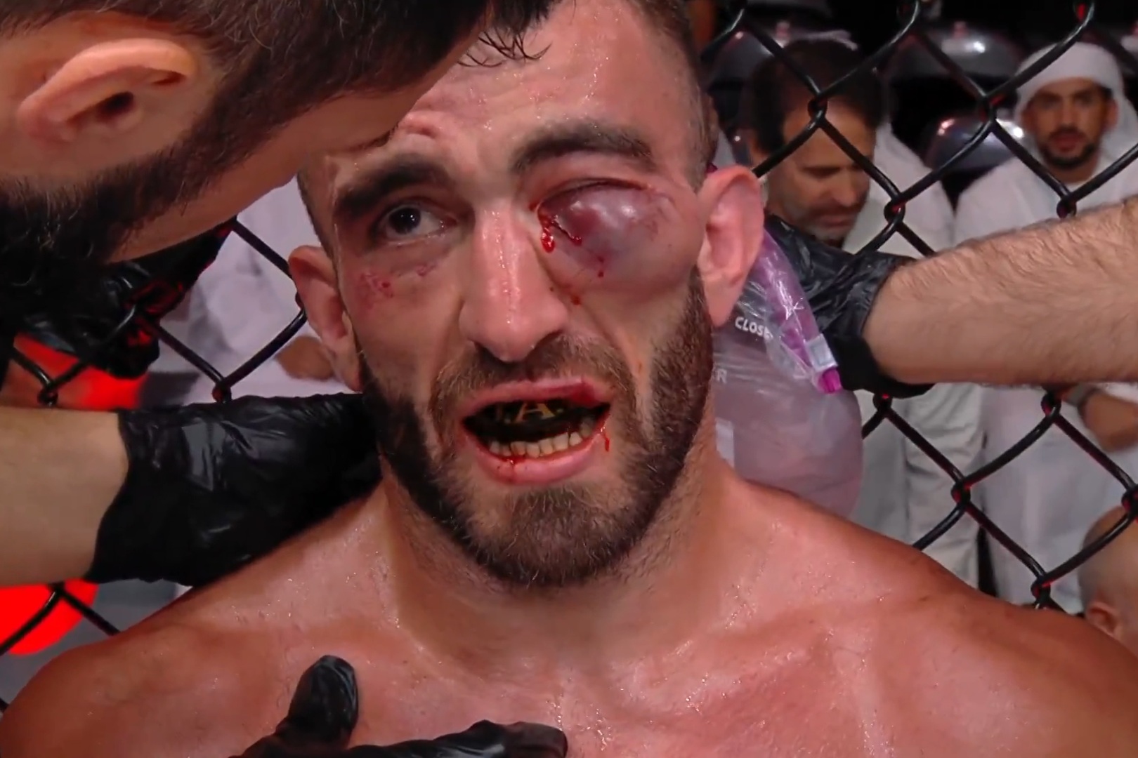 Fatalna kontuzja w UFC. Sędzia przerwał walkę [WIDEO]