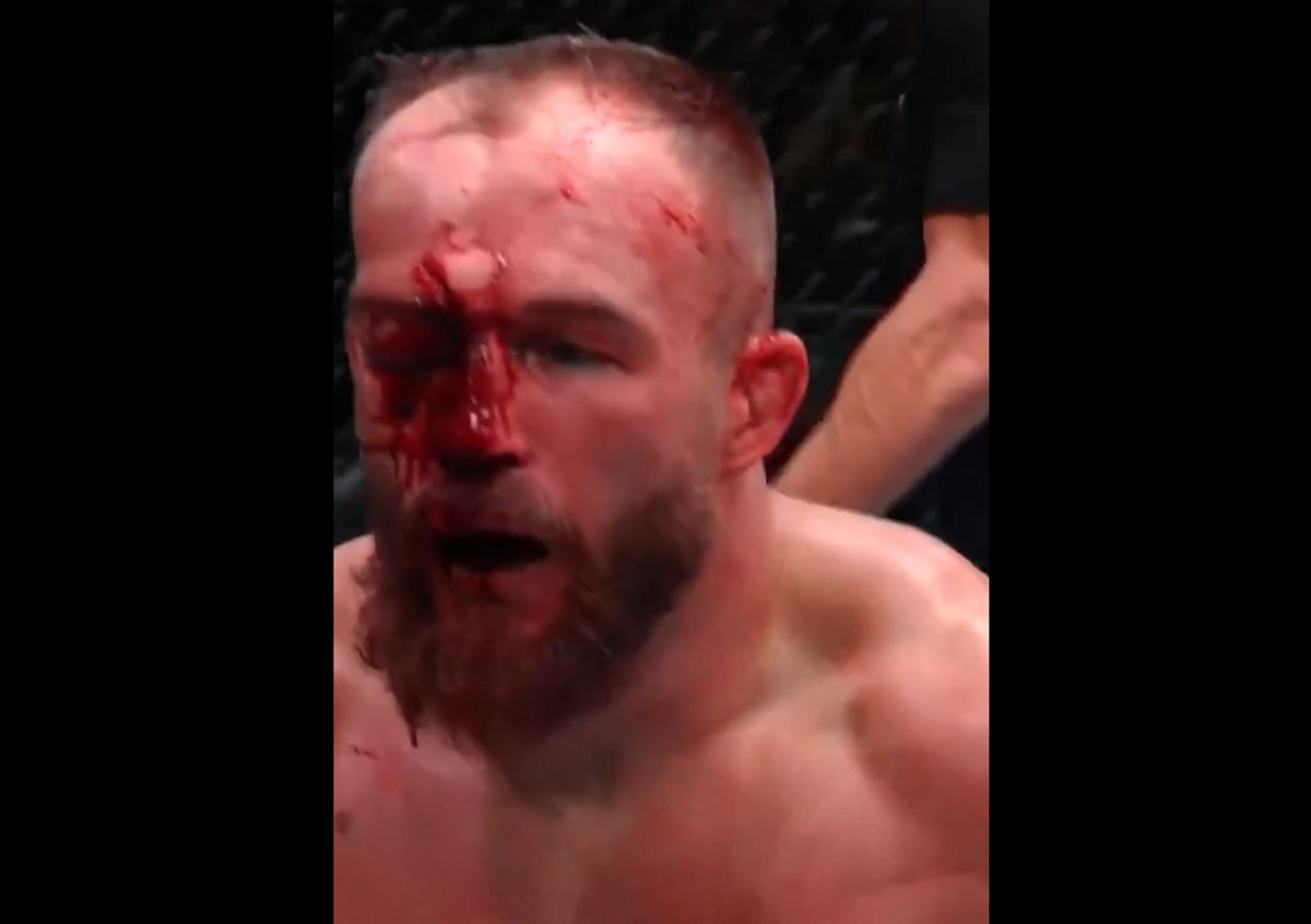 Twarz Polaka kompletnie zmasakrowana. Krwawa łaźnia na UFC [WIDEO]