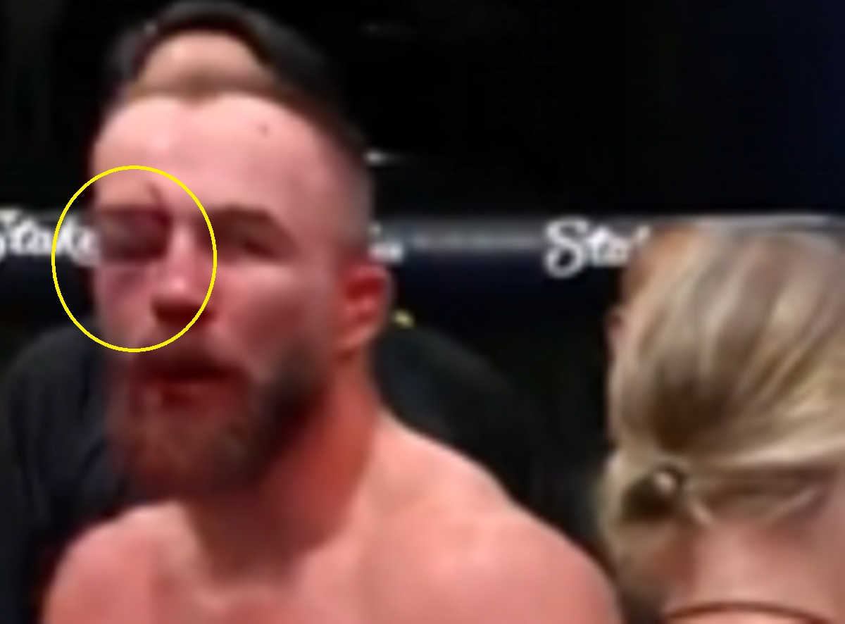 Zdemolowana twarz Polaka po gali UFC. Jakby przejechał po nim walec [ZDJĘCIE]
