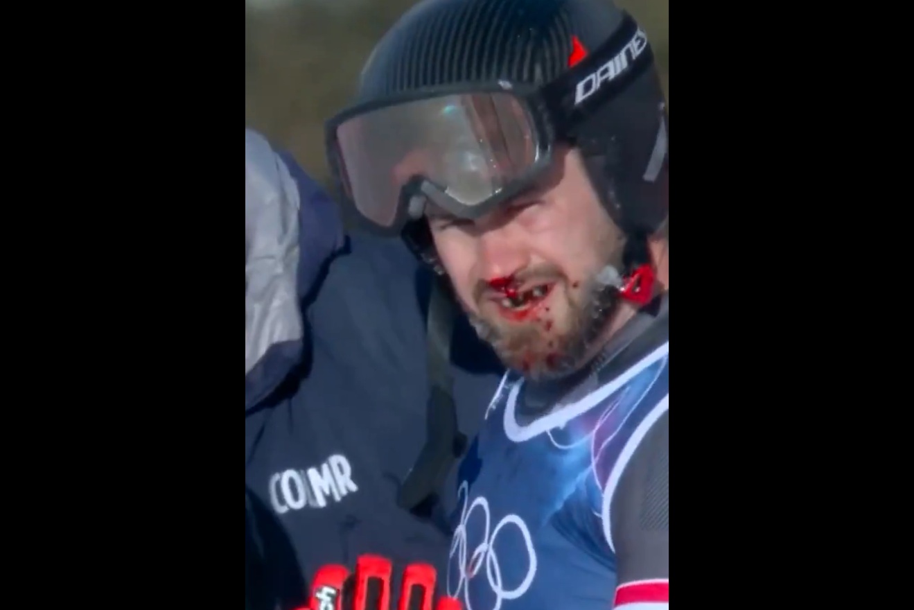 Dramatyczne sceny przed startem IO. Krew lała się strumieniami [WIDEO]