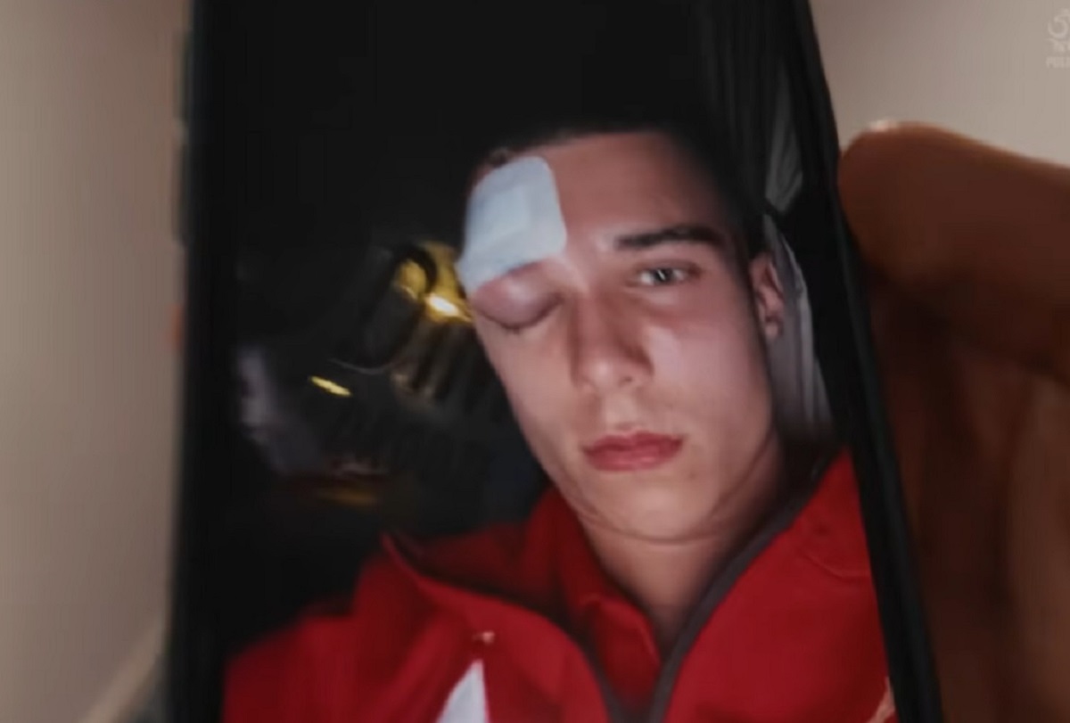 Kuziemka opowiedział o fatalnym urazie. Nie mógł nawet otworzyć oka