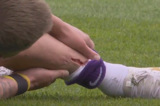 Dramat na murawie. Skończył z dziurą w nodze [WIDEO]