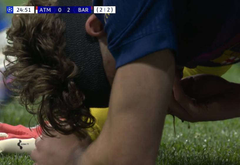 Chwile grozy w meczu Barcelony. Polała się krew [WIDEO]