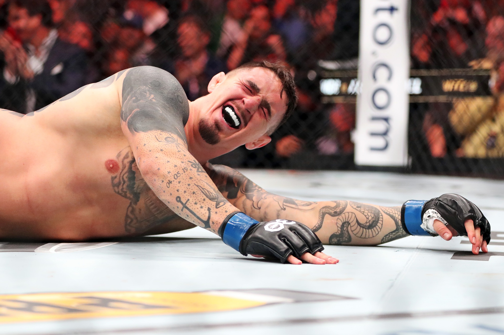 Makabryczne wyznanie mistrza UFC. "Musiałem przejść trzy operacje"