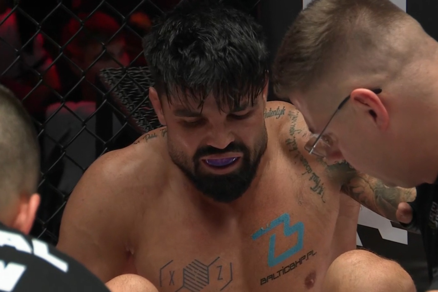 Kontuzja na Fame MMA 33! To wyglądało dramatycznie
