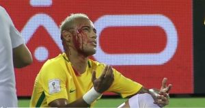 Eliminacje MŚ: Brazylia znów gra pięknie, Neymar zszedł z rozciętym łukiem brwiowym [VIDEO]