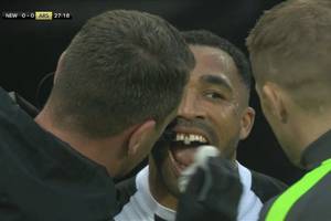 Boli od samego patrzenia. Kamery pokazały, co stało się z zębem napastnika Newcastle United