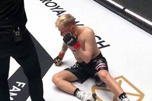 Freakfighter pokazał zmasakrowaną twarz po walce na Fame MMA 20. Ma połamany nos i pęknięty oczodół [ZDJĘCIE]