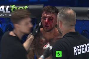 Zmasakrowana twarz freakfightera. Tak wyglądał po walce na Prime MMA 9 [ZDJĘCIE]