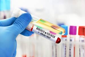 Wykryli doping u wszystkich piłkarek. Tego jeszcze nie było